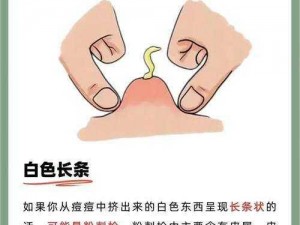 有趣的科普：你知道为什么豆豆能挤出白液体吗？