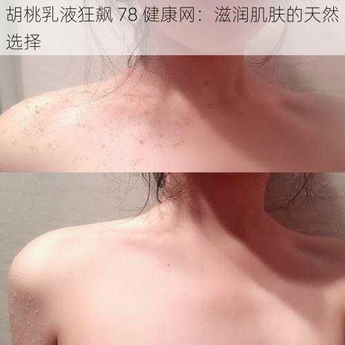 胡桃乳液狂飙 78 健康网：滋润肌肤的天然选择